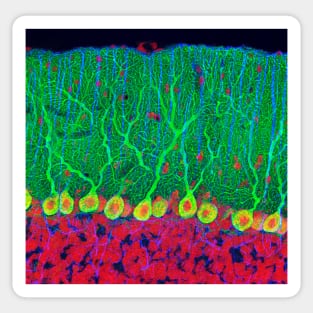 Purkinje nerve cells in the cerebellum (P360/0474) Sticker